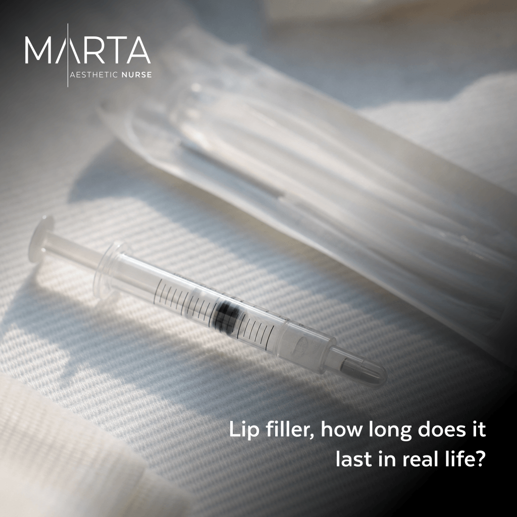 Lip filler, how long does it last in real life?
