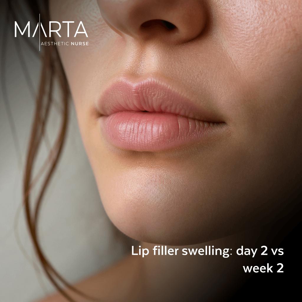 Close up of relaxed lips at rest in soft window light, with natural skin texture visible.