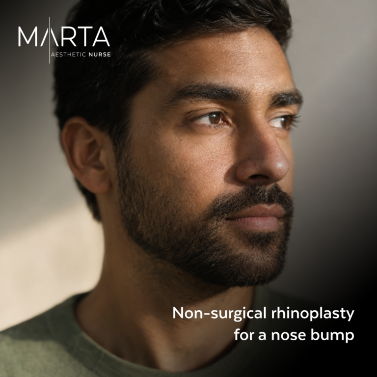 Non-Surgical Rhinoplasty for Bumps: What Changes